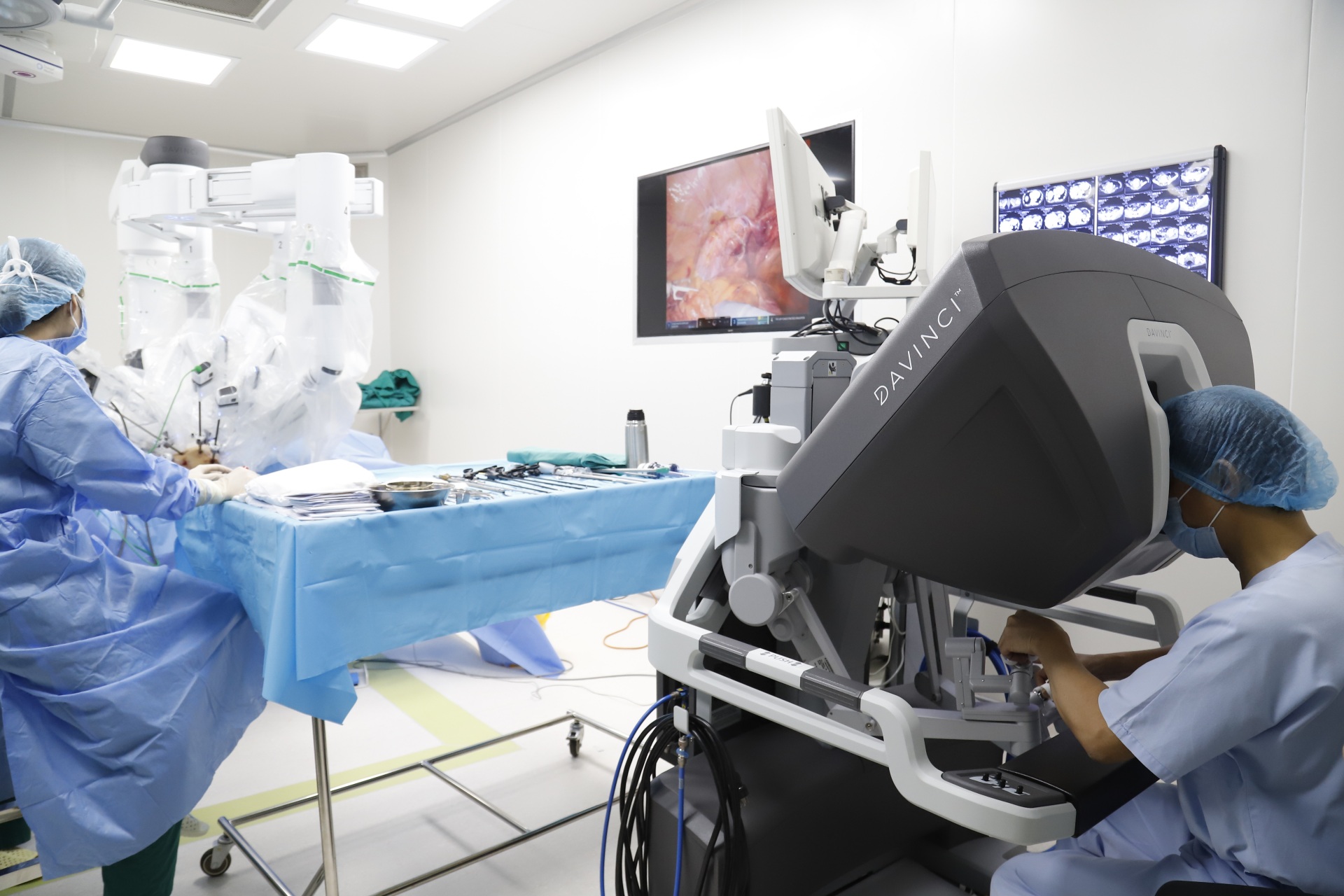 Các bác sĩ Bệnh viện K thực hiện ca phẫu thuật nội soi với hệ thống rô-bốt Da Vinci Xi cho người bệnh ung thư.