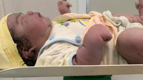 Bé gái sơ sinh nặng 5,5kg chào đời bằng phương pháp sinh thường