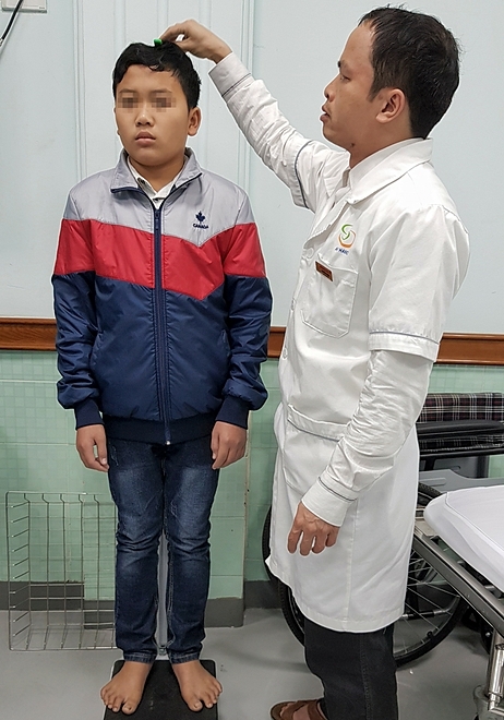 Nam thanh niên (trái) đứng cạnh bác sĩ, một năm trước cao 1,5 m, thấp hơn bác sĩ nửa đầu. Ảnh: Bác sĩ Hưng cung cấp