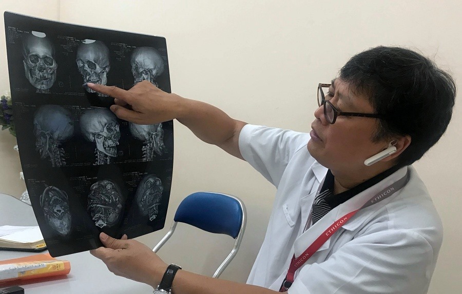 PGS.TS Nguyễn Đức Chính, Trưởng khoa Phẫu thuật nhiễm khuẩn cho biết hiện bệnh nhân vẫn còn hiện tượng bị ảo giác.