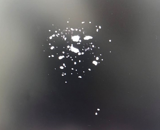 Hình ảnh cản quang của chì trên phim X-quang.