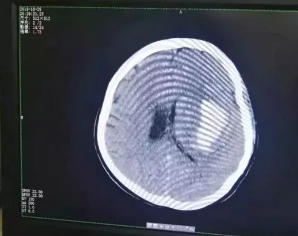 Hình ảnh chụp CT não của Trân Trân.