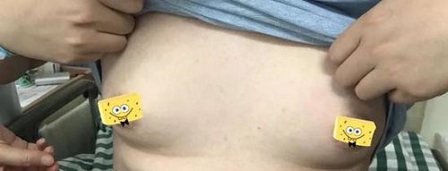 Hình ảnh bộ ngực dị thường của Tiểu Vương