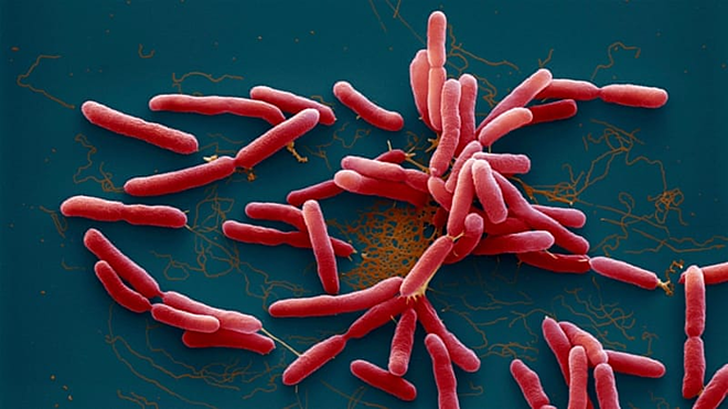 Vi khuẩn Burkholderia pseudomallei gây bệnh Whitmore. Ảnh: aljazeera