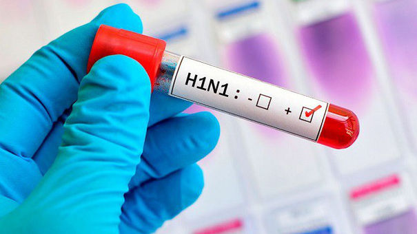 Bệnh nhi 27 tháng tử vong do cúm A/H1N1