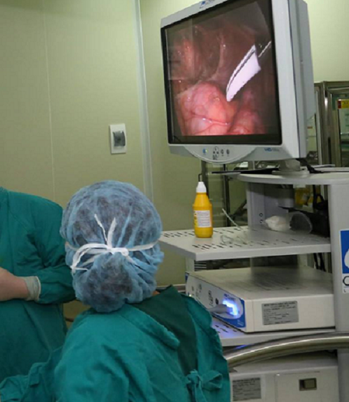 Bệnh nhân được tiến hành phẫu thuật nội soi, làm hậu môn nhân tạo - Ảnh: Bệnh viện cung cấp