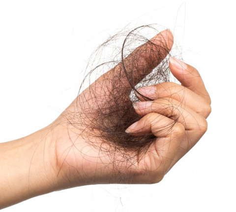 Cấy tóc là phương pháp mang hiệu quả nhất cho những người hói đầu