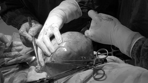 Tin uống thực phẩm chức năng, người phụ nữ Hà Nội suýt mất mạng