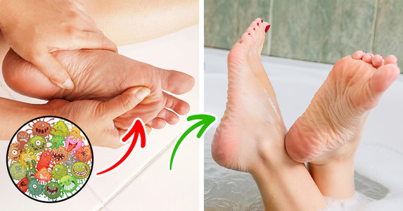 Lười 1 phút rửa chân khi tắm có thể khiến bạn ân hận khi mắc phải các căn bệnh sau