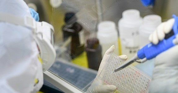 Cơ chế gây chết người của virus corona