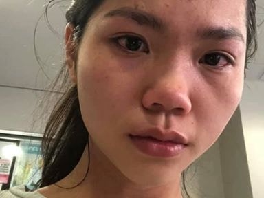 Vietnamese woman claims she was attacked in Australia for wearing a mask