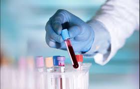 Tìm người dễ mắc Covid-19