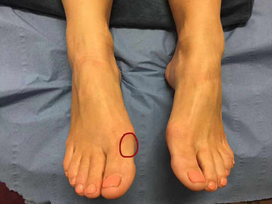 Bàn chân xuất hiện 8 điểm này tuyệt đối không được lơ là vì có thể là dấu hiệu bệnh nguy hiểm