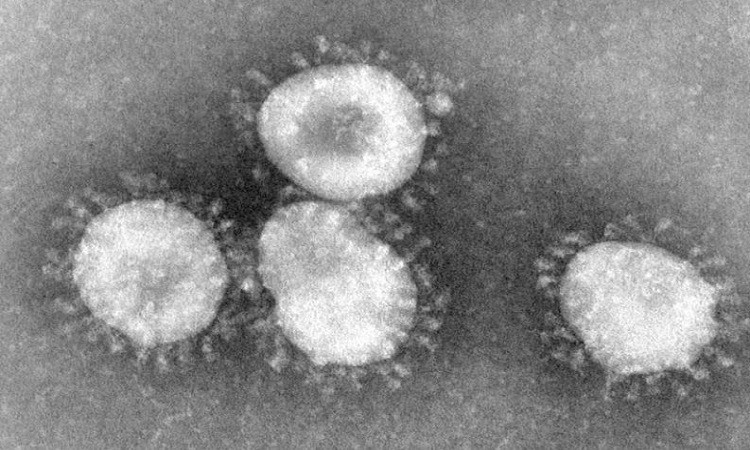 Virus corona quan sát qua kính hiển vi điện tử. Ảnh: National Geographic.