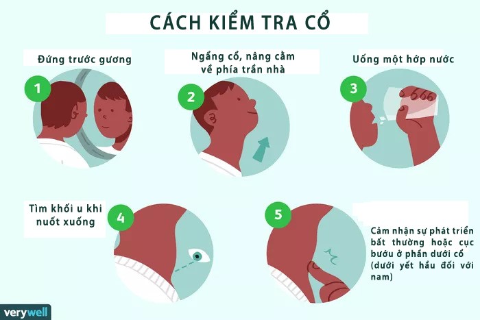 Các bước kiểm tra cổ tại nhà. Ảnh: Verywellhealth