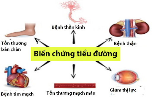 Biến chứng tiểu đường