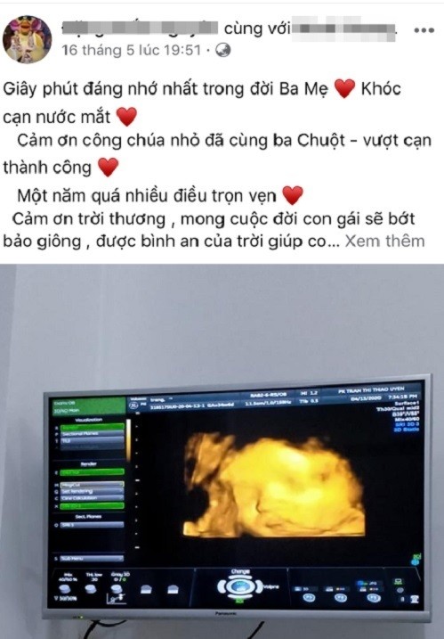 Minh Anh chia sẻ trên trang cá nhân hình ảnh siêu âm em bé trong bụng, khi sinh con thành công..