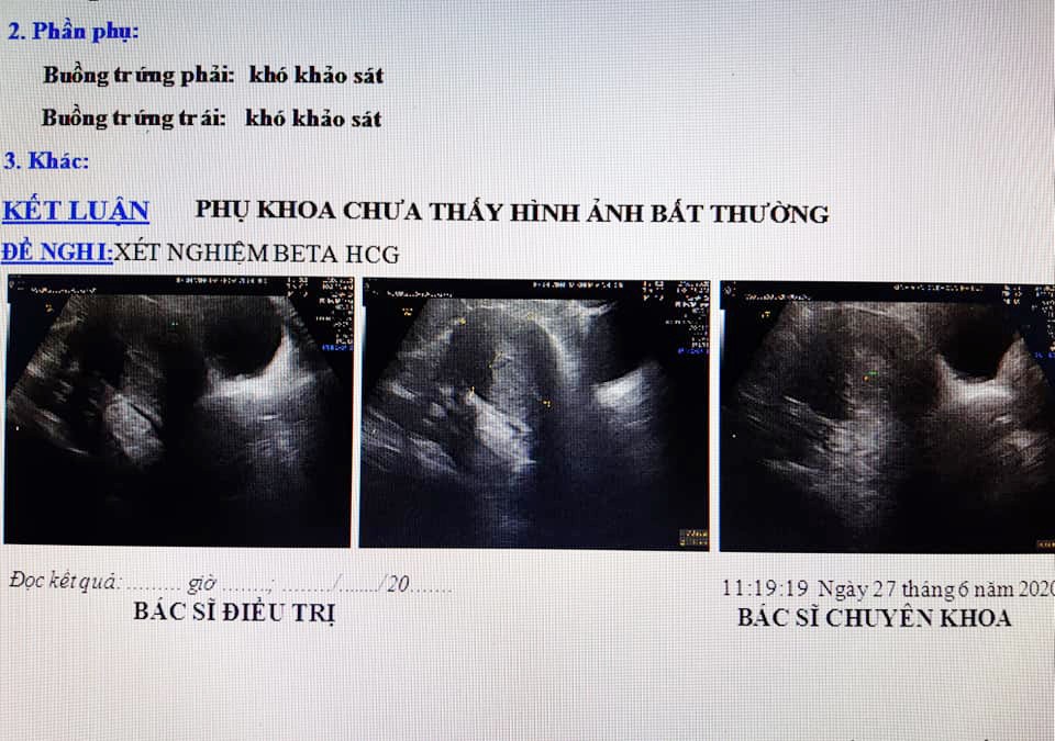 Kết quả xét nghiệm của người phụ nữ. Ảnh: Bửu Thuyên.