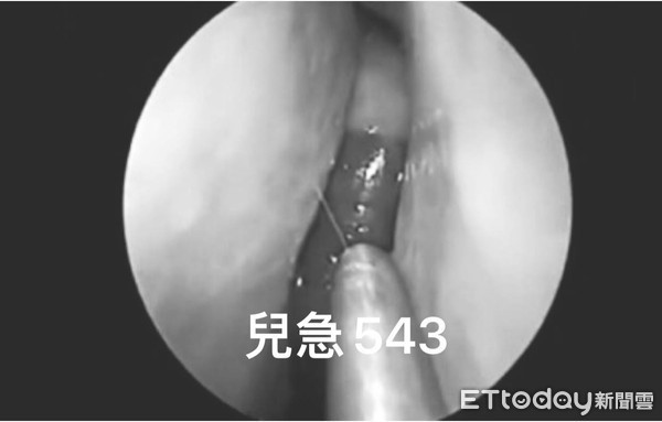 Con đỉa có kích thước dài khoảng 5 cm.