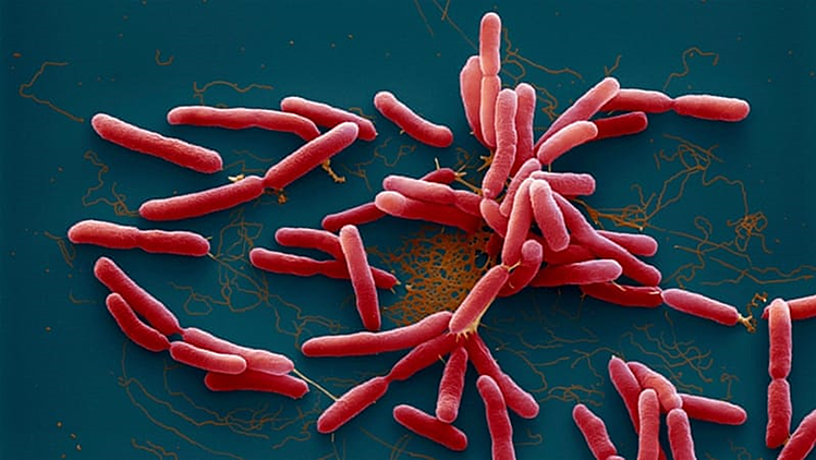 Vi khuẩn Burkholderia pseudomallei gây bệnh Whitmore. Ảnh: Aljazeera