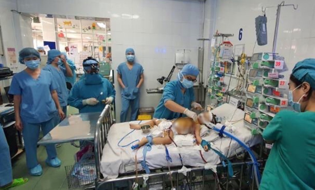 Các bác sĩ can thiệp ECMO cho bệnh nhi ngay tại giường. Ảnh: Bệnh viện cung cấp.