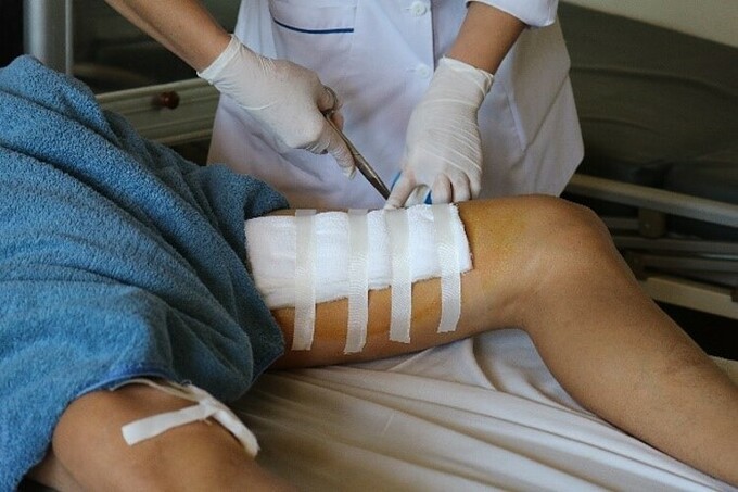Vết thương đùi trái của người bệnh được bác sĩ băng bó. Ảnh: Bệnh viện cung cấp