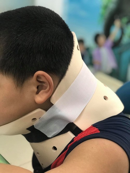 Bé trai đã được các bác sĩ nẹp cố định cột sống cổ