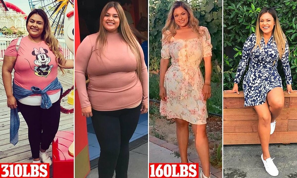 Natalie lột xác giảm 68 kg sau khi phẫu thuật cắt 80% dạ dày. Ảnh: Daily Mail.