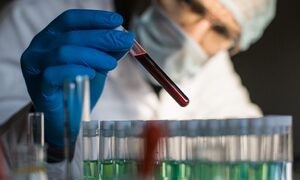 Xét nghiệm máu phát hiện 50 loại ung thư
