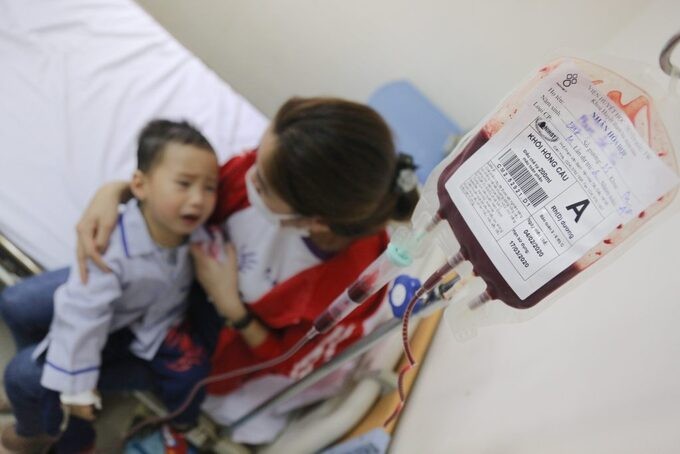 Một em bé mắc Thalassemia đang điều trị tại Viện Huyết học - Truyền máu Trung ương. Ảnh: Công Thắng.