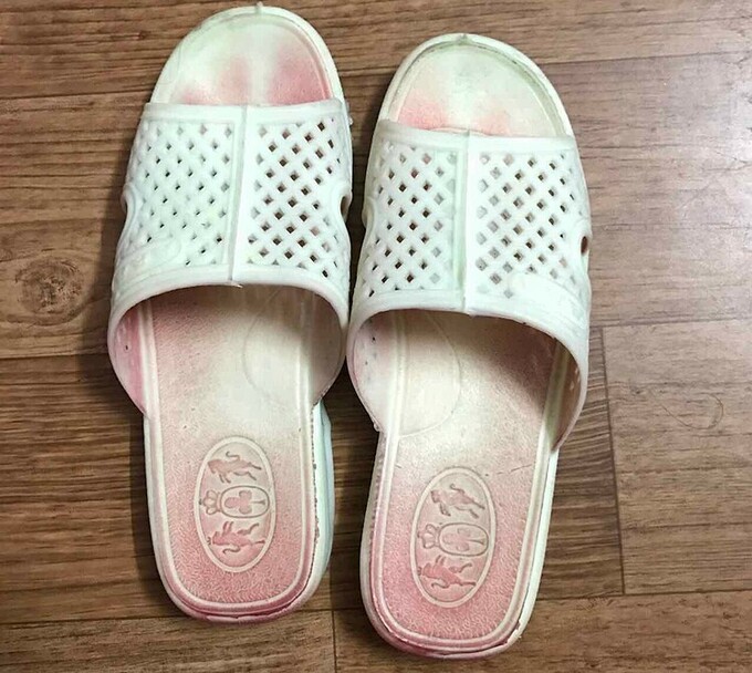 Đôi dép bệnh nhân đi. Ảnh: Bác sĩ cung cấp