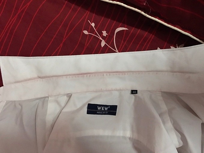 Hiện tượng ‘mồ hôi máu’ lần đầu phát hiện tại Việt Nam