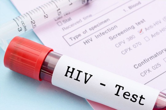 15 tuổi có quyền tự nguyện xét nghiệm HIV