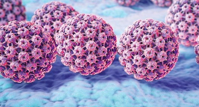 Sùi mào gà do virus HPV gây ra. Ảnh: Guardian