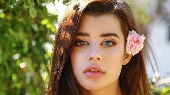 Hội chứng tiềm ẩn sau những đôi mắt hai màu mê hoặc