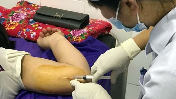 Mang bầu 18 tuần, người phụ nữ Quảng Ninh liều lĩnh tự phá thai tại nhà