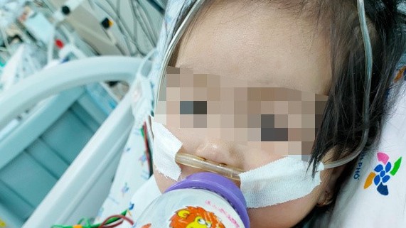 Bé gái 15 tháng tuổi nguy kịch vì biến chứng tay chân miệng