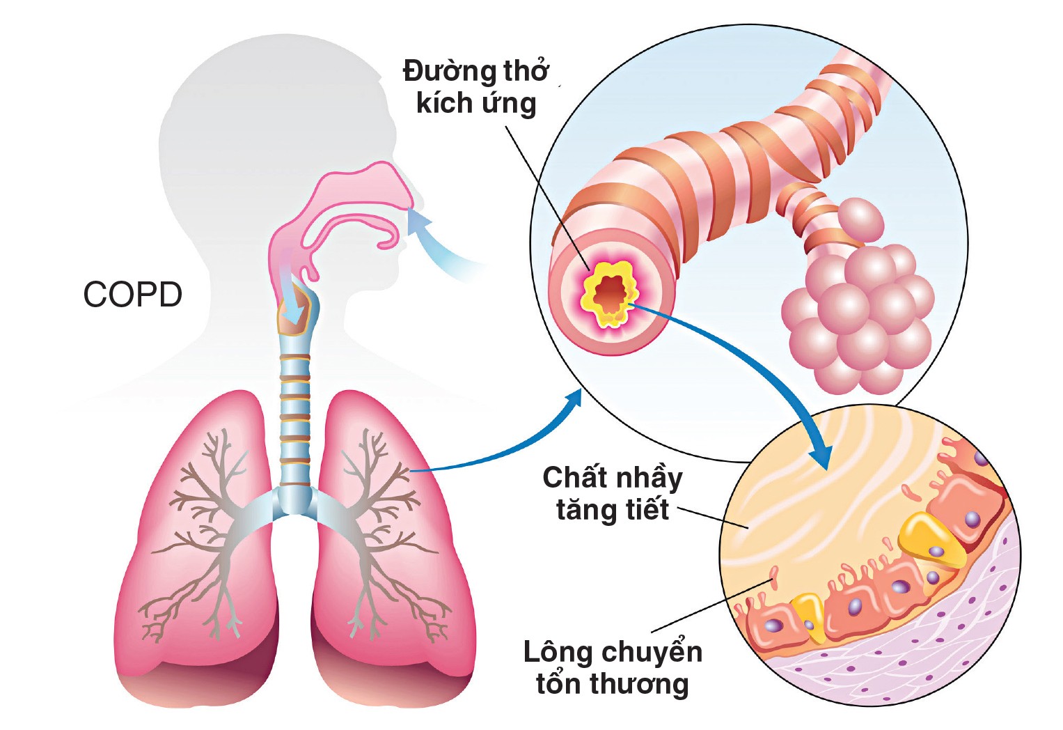 Dịch nhầy đường hô hấp - Ảnh minh họa