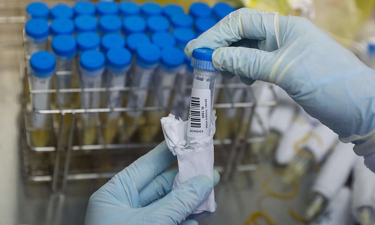 A medic holds a tube containing samples taken for the new coronavirus test in HCMC, 2020. Photo by VnExpress/Quynh Tran.