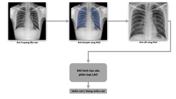 Quy trình dạy máy phân loại bệnh lao