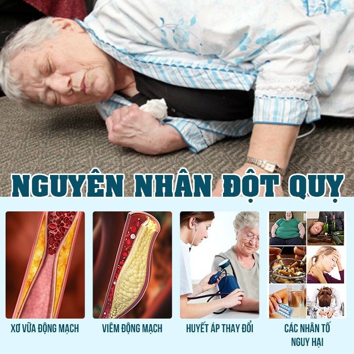 Nguyên nhân gây đột quỵ