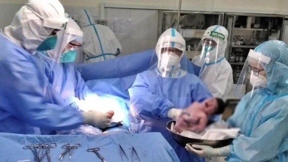 Thai phụ mắc Covid-19 suy hô hấp đã sinh thường con gái khỏe mạnh