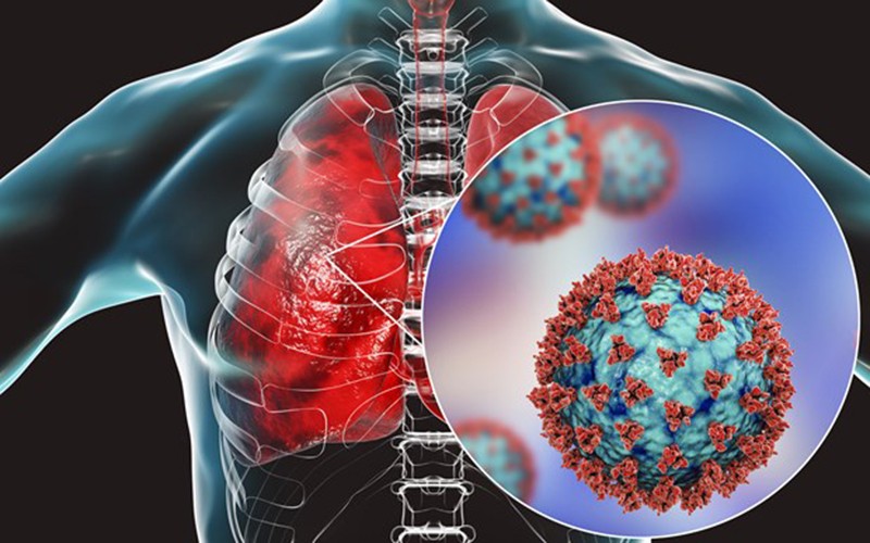 Virus SARS-CoV-2 tấn công khiến phổi bị suy giảm chức năng hô hấp. (Ảnh: TTXVN/Science Photo)