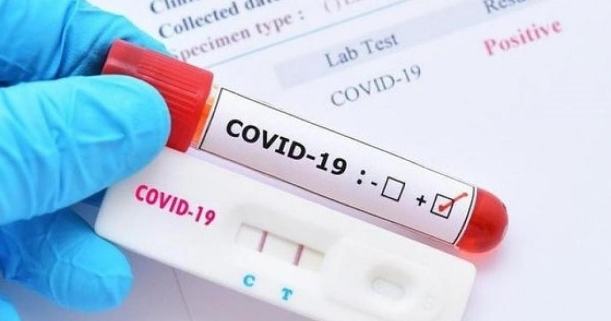 Nhập “khủng” kit test Covid-19, Công ty Cổ phần Y tế Đức Minh nói gì?