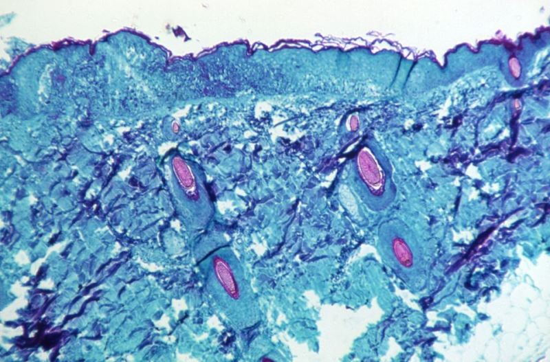 Hình ảnh một phần mô, được lấy từ vết thương trên da của 1 con khỉ nhiễm virus đậu mùa khỉ, được phóng đại 50X vào năm 1968. (Ảnh: REUTERS)