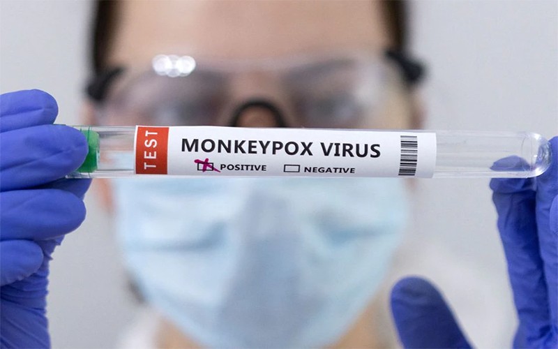 Đợt bùng phát bệnh đậu mùa khỉ được dự báo sẽ không trở thành đại dịch