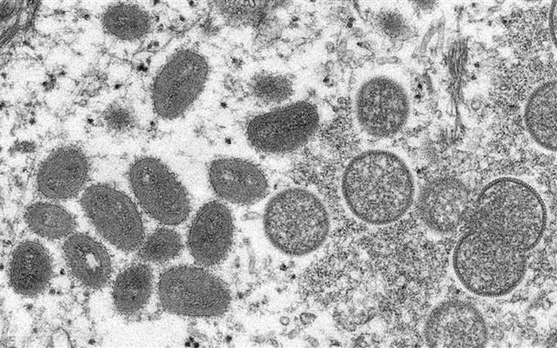 Hình ảnh virus đậu mùa khỉ dưới kính hiển vi điện tử. (Ảnh: AFP/TTXVN)