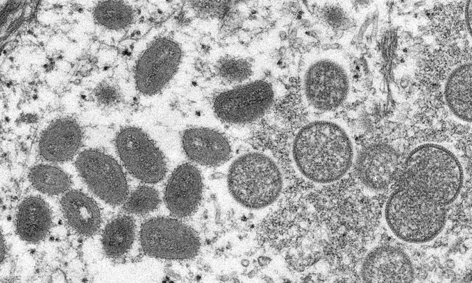 An electron microscopic (EM) image shows mature, oval-shaped monkeypox virus particles as well as crescents and spherical particles of immature virions. Photo by Cynthia S. Goldsmith, Russell Regnery/CDC/Handout via Reuters