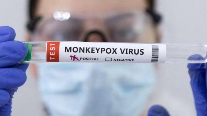 WHO chưa khuyến cáo dùng rộng rãi vaccine đậu mùa khỉ