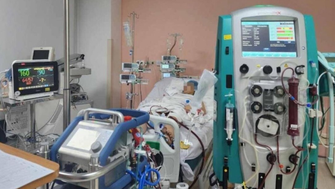 Cô gái 22 tuổi viêm cơ tim cấp may mắn thoát cửa tử nhờ kỹ thuật ECMO